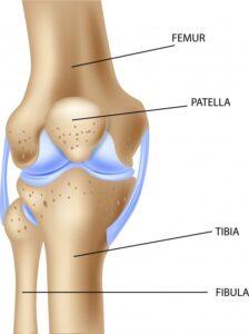 Hva skjer når kneskålen går ut av ledd (patellaluksasjon)? 1 illustration human knee joint anatomy 29190 954 224x300 1
